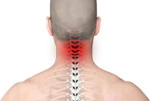 Neck Pain