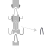 MILD Procedure - Minimally Invasive Lumbar Decompression